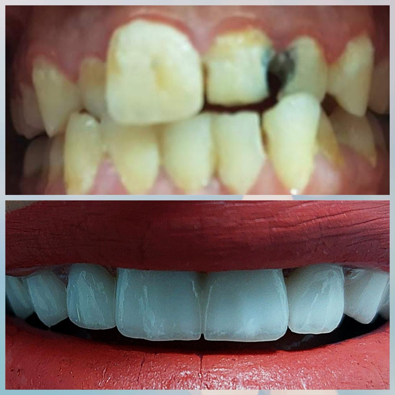 Before and After Case 1