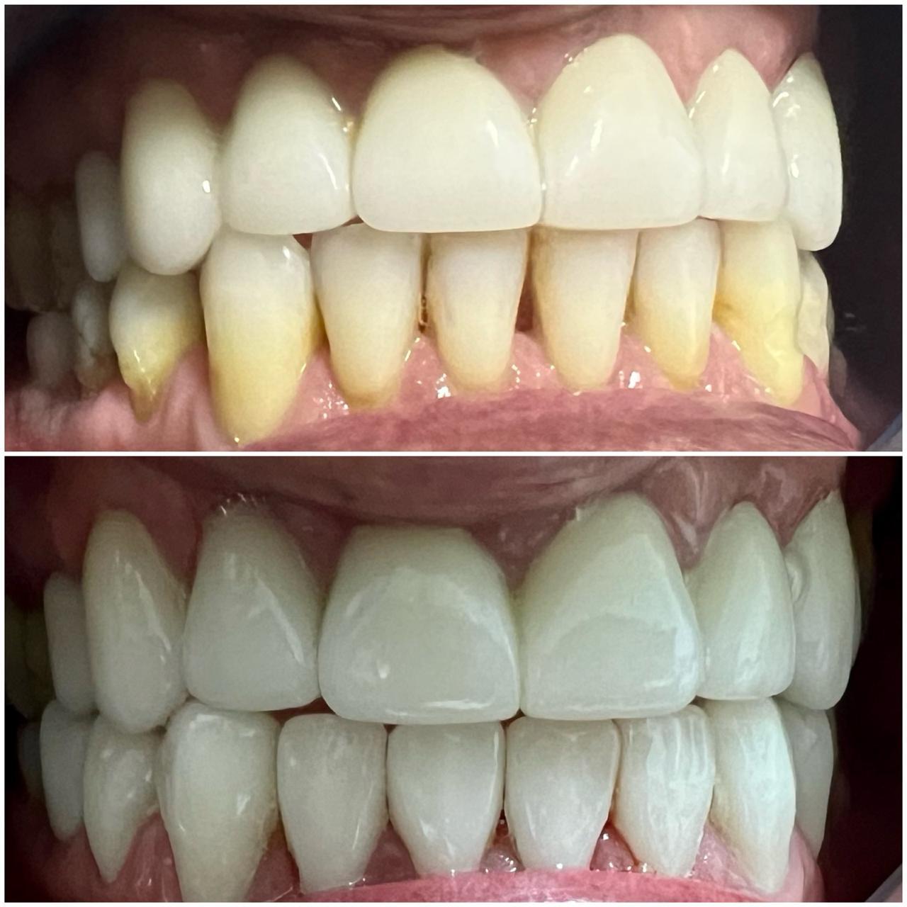 Before and After Case 2