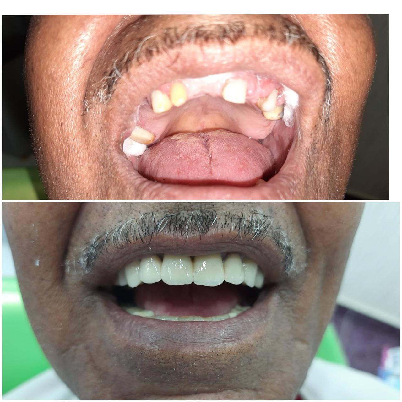 Before and After Case 3