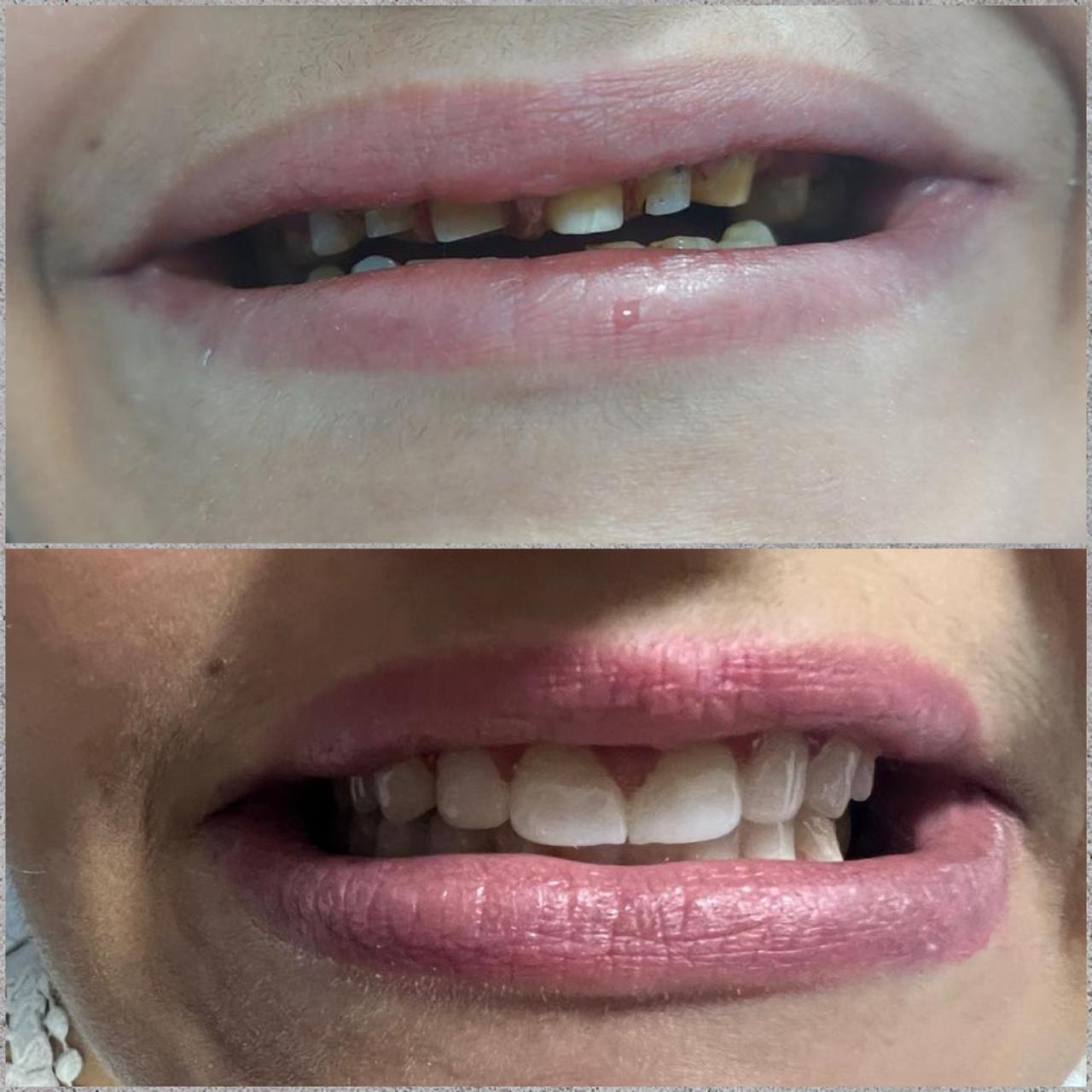 Before and After Case 4