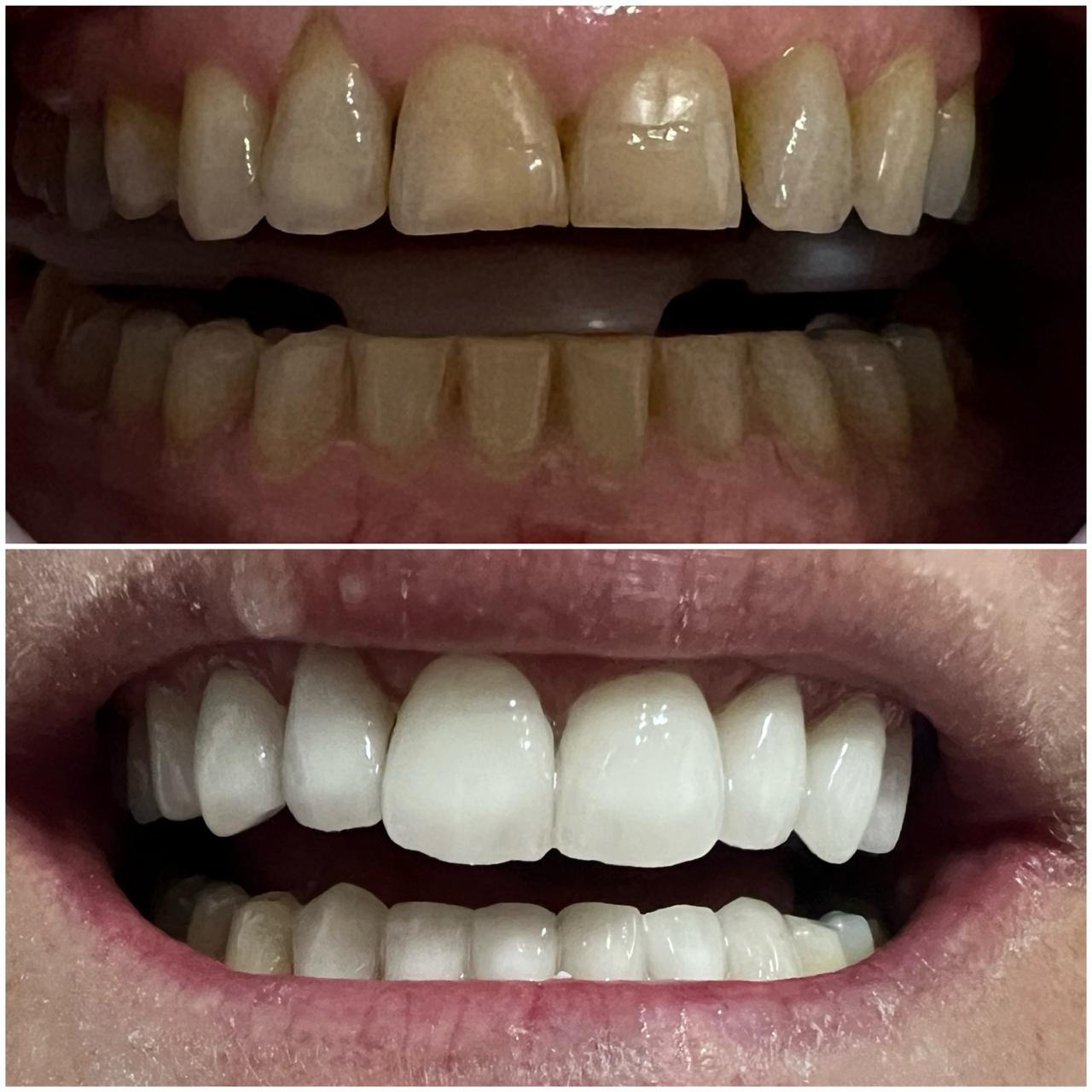 Before and After Case 5