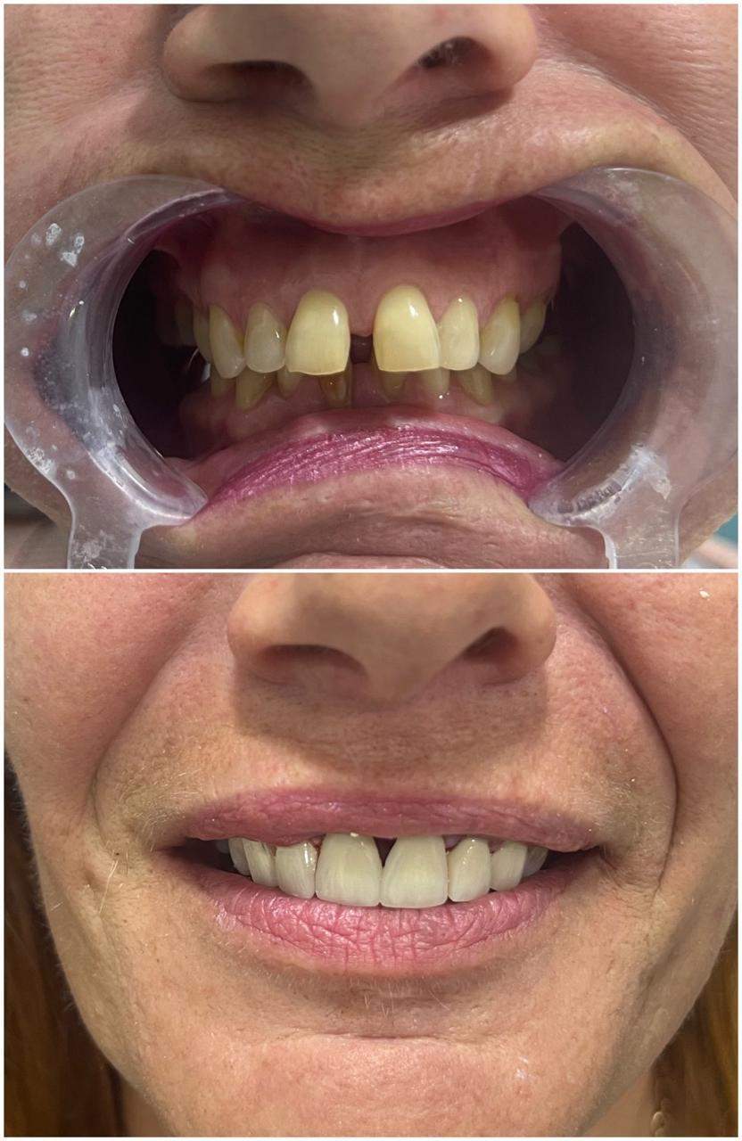 Before and After Case 7